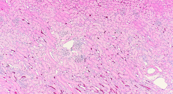Slide of Kidney Microscope view of collected tissue.