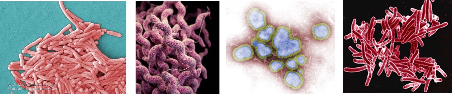Reportable Diseases