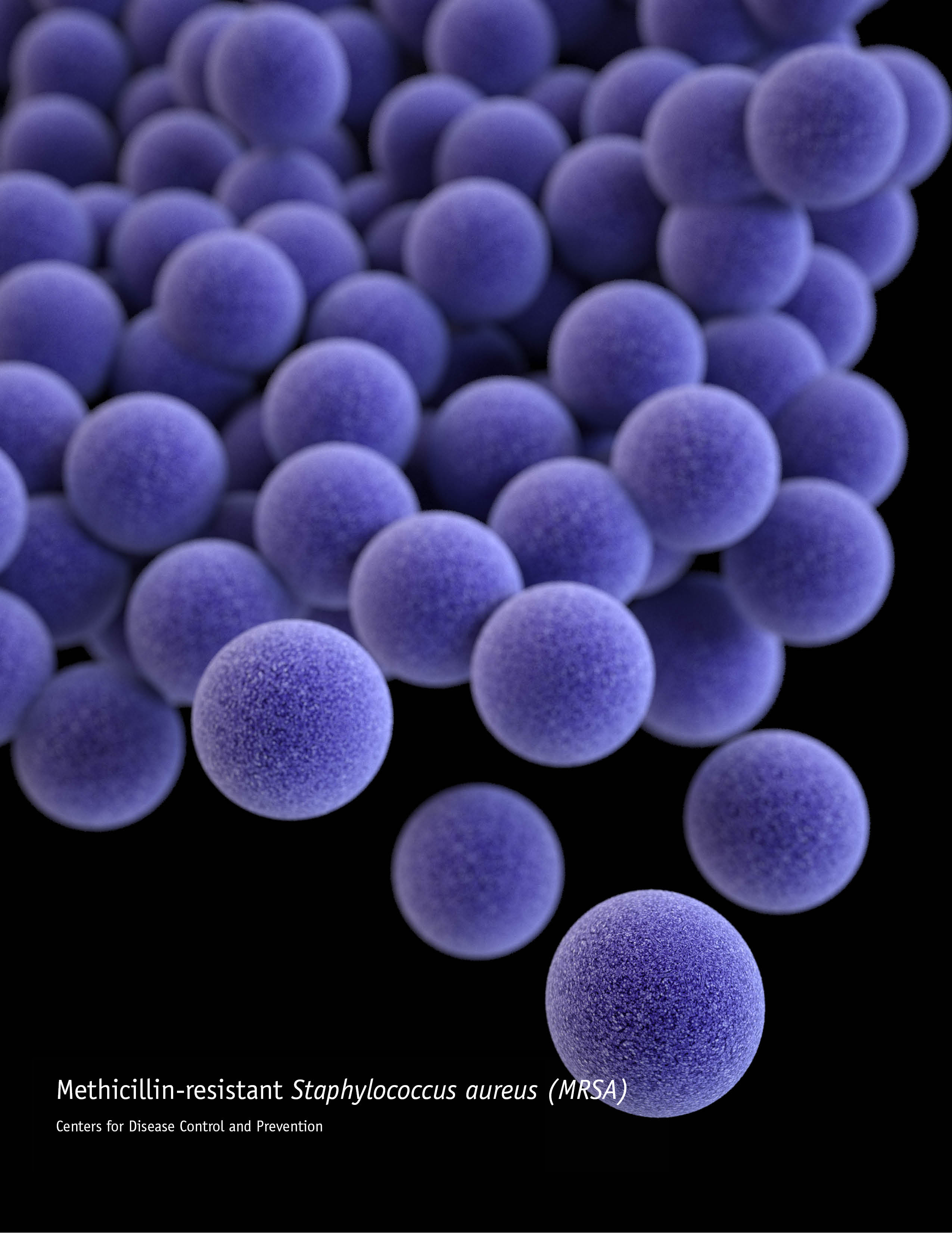 MRSA (Methicillin-Resistant Staphylococcus Aureus) Infection -  Willis-Knighton Health System