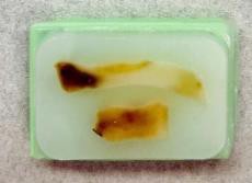 Processed tissue sample.