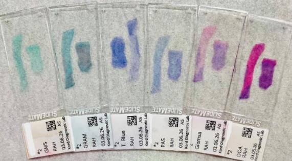 Slides identifying cellular changes associated with disease.