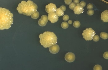 Cronobacteria Cronobacteria