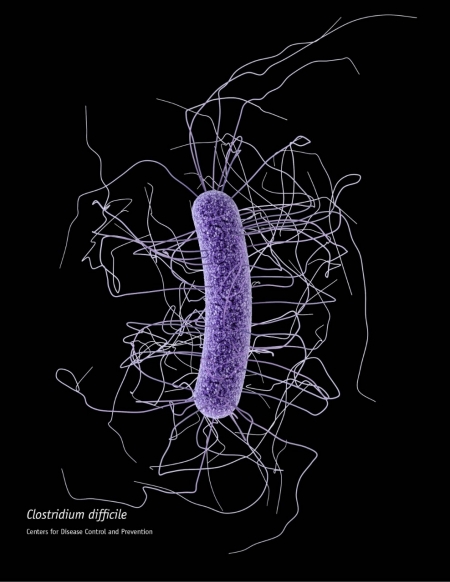 Healthcare-Associated Infections: Clostridium difficile Healthcare-Associated Infections: Clostridium difficile