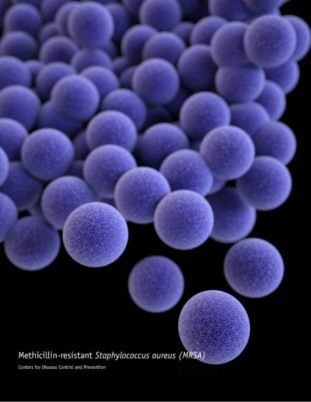 Staphylococcus aureus:  Methicillin- Resistant Invasive Disease