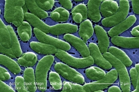 Vibriosis (Non-Cholera)