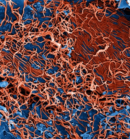 Viral Hemorrhagic Fever (Ebola virus disease, Lassa fever, Marburg virus) 