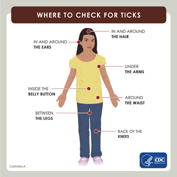 Diagram of the human body with highlighted regions to check for ticks. In and around the hair, in and around the ears, under the arms, inside the belly button, around the waist, between the legs, and the back of the knees.