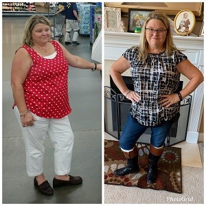 A before and after photo weight loss photo of Debrorah