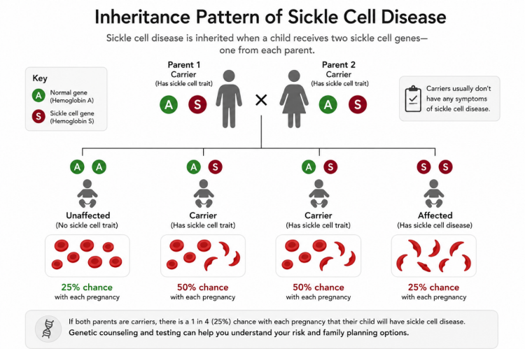 Infographic of sickle cell disease inheritance pattern.